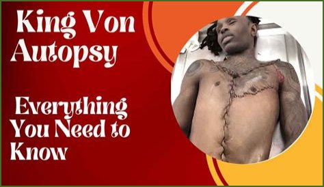Discover The Shocking Truth: King Von's Autopsy Photos Revealed